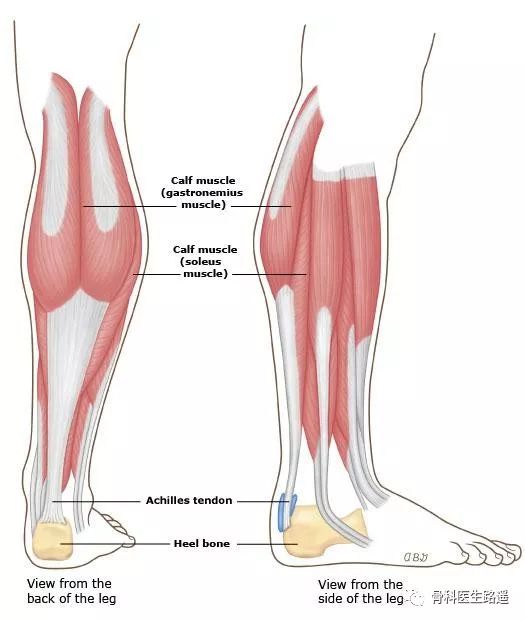 运动完脚后跟疼跟腱炎该如何防治