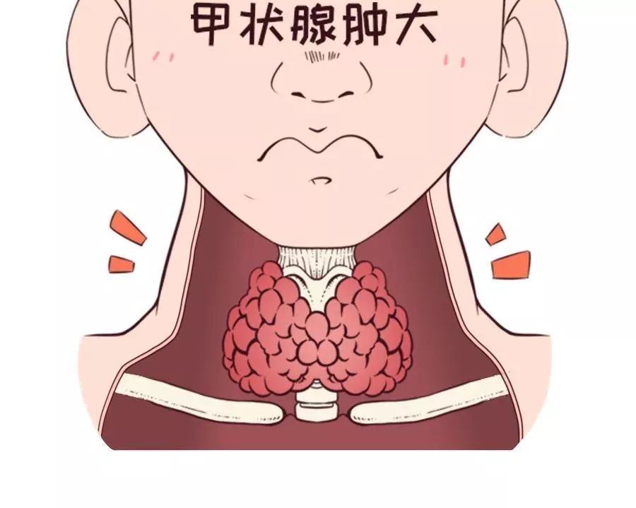 甲状腺疾病为何"偏爱"女性?该如何预防?_手术