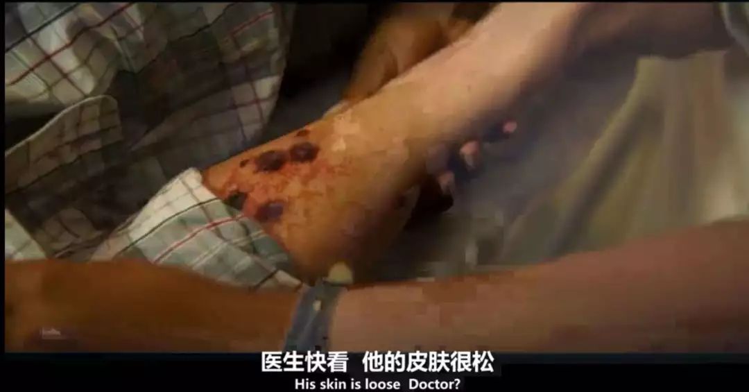 密集恐惧症慎入四级死亡病毒来袭活着成为乞求