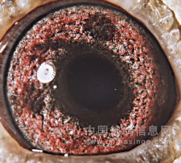 【图集】神秘的鸽眼黑斑!_镜片