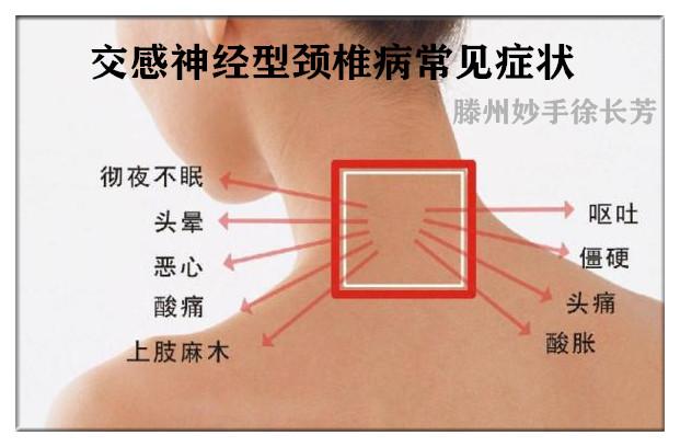滕州推拿颈椎病中最流氓的类型交感神经型颈椎病徐长芳