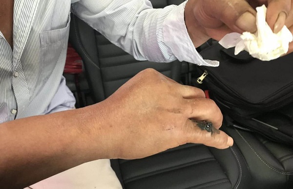 来安一村民被毒蛇咬伤,天长一警车连闯红灯生死接力_吴乃平