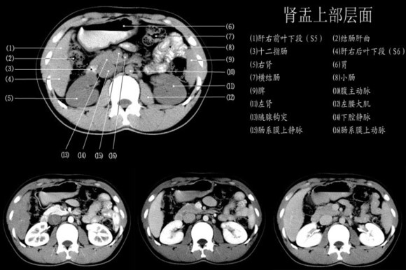 【经典】1小时读懂腹部ct