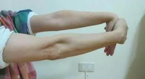 3,屈腕拉伸动作要领:立正抬头挺胸,两手稍抬高并使两手臂屈曲于体前.