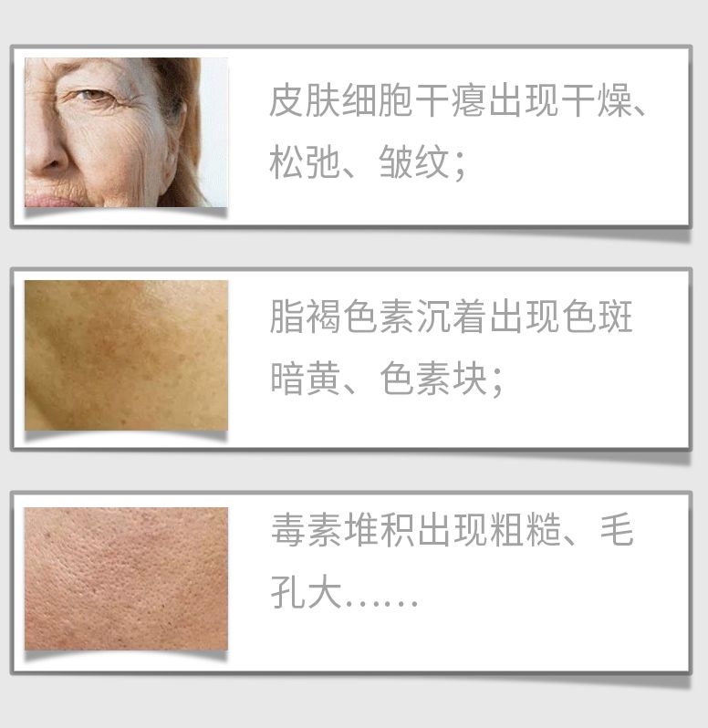 珍奢鲟鱼子酱提取物和c60富勒烯的完美糅合全面狙击衰老元凶——自由