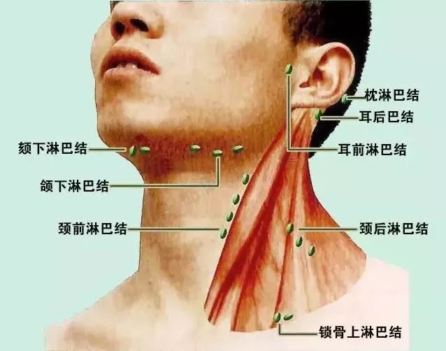 脖子淋巴疼痛的位置图图片