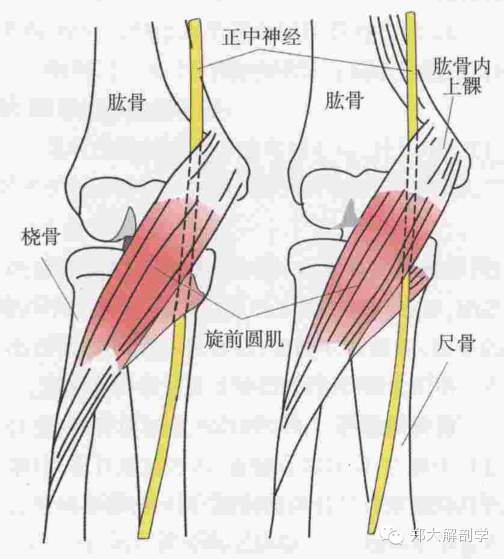 下行,通過struthers韌帶,到達肘窩繼續向下穿旋前圓肌和指淺屈肌鍵弓