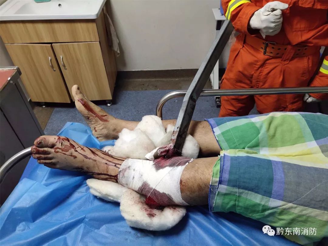 80厘米钢管刺穿男子左腿 凯里消防手术台上紧急救援
