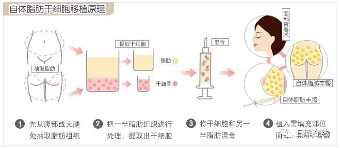干细胞抗衰老，打开时间之门的新篇章