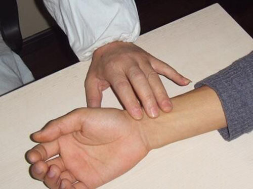 其病理变化常可由脉象反映出来,肿瘤患者常见脉象有沉,细,弱,弦,浮,滑