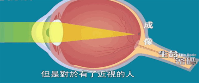 "如果家长发现孩子视力模糊后,第一时间就来医院进行专业检查,可能不