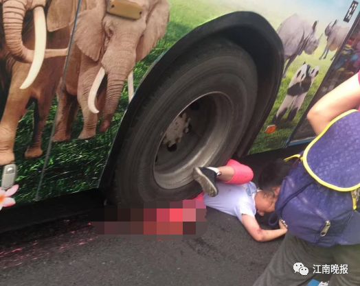最新市中心妇幼附近女孩一条腿几乎被碾碎