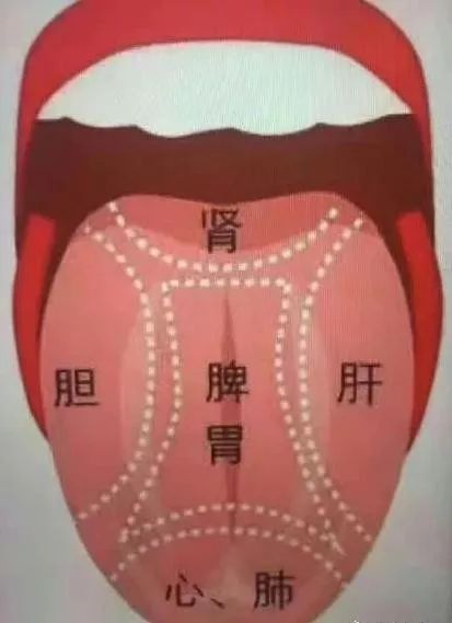 宝宝舌头有斑块患了地图舌怎么办