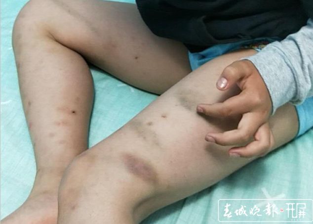 云南7岁童被老师体罚目前涉事教师已向家属道歉