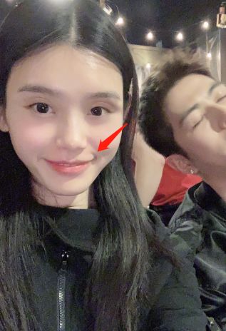 羊觉得叫它"矫情纹"还是有点道理的吼.