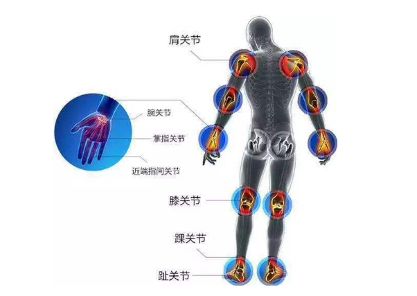 很多人都忽略了类风湿关节炎的这6个部位锻炼法其实很有效