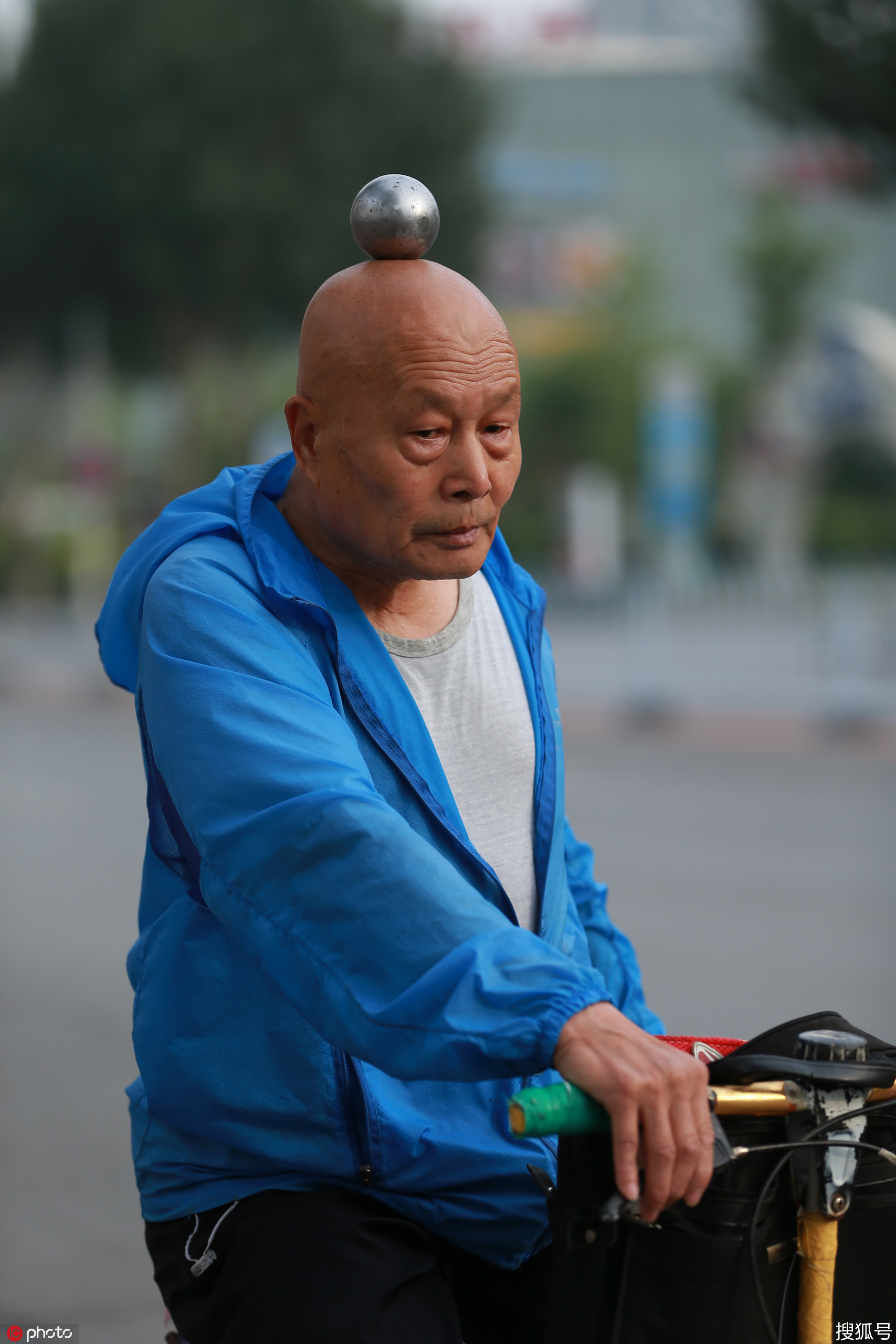 沈阳7旬大爷头顶钢球练8年"平衡功" 脑上砸出坑