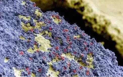 蓝色的球形地毯细菌和红细胞,紧贴在黄牙表面