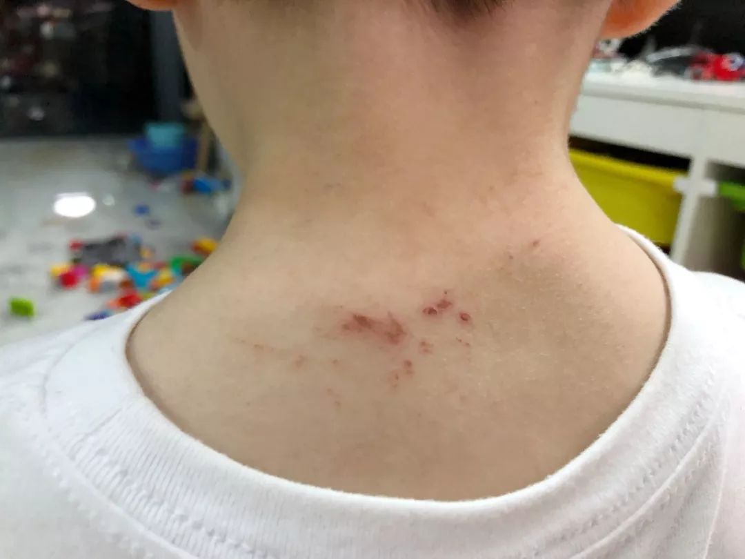 热出痱子睡不好这4件单品让宝宝睡个安稳觉