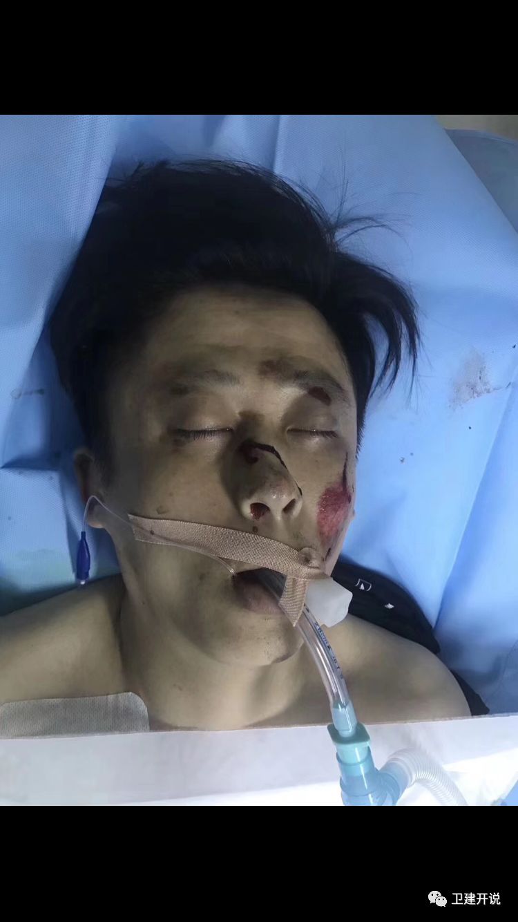 濱州一男子車禍住進人民醫院icu!正在手術,急尋家屬!