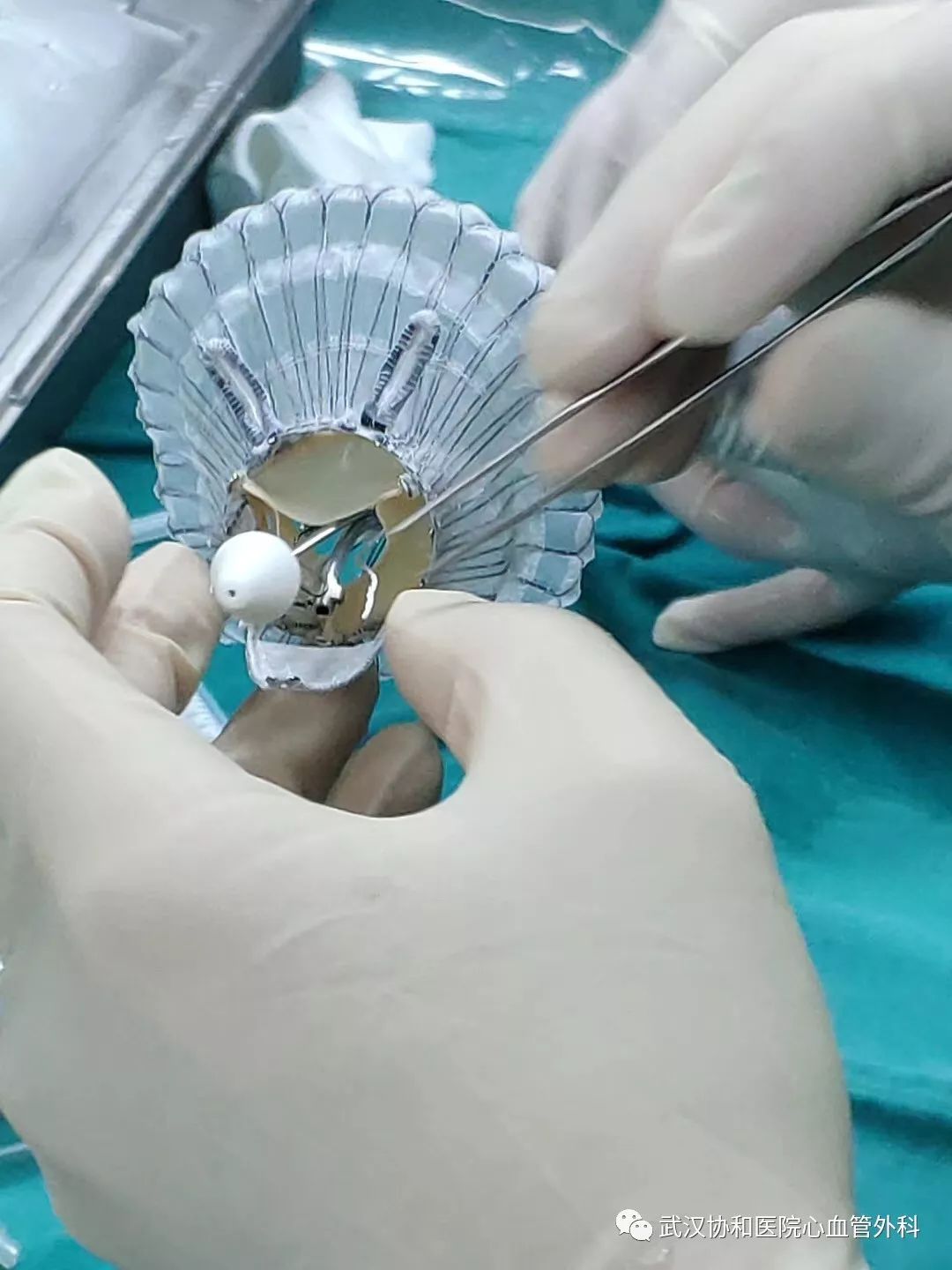 医讯华中地区首次经导管三尖瓣置换在武汉协和医院心外科完成