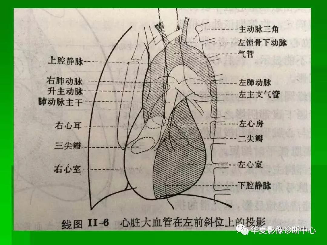 心尖区位置图片图片