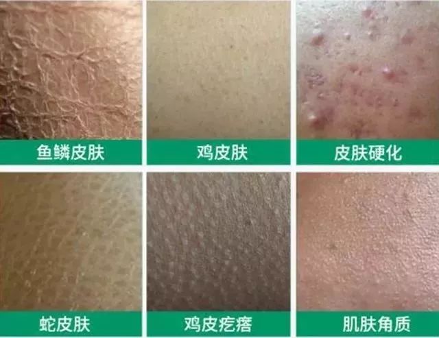 有了这个专门清理毛孔污垢的沐浴刷再也不用担心洗澡搓不干净后背了