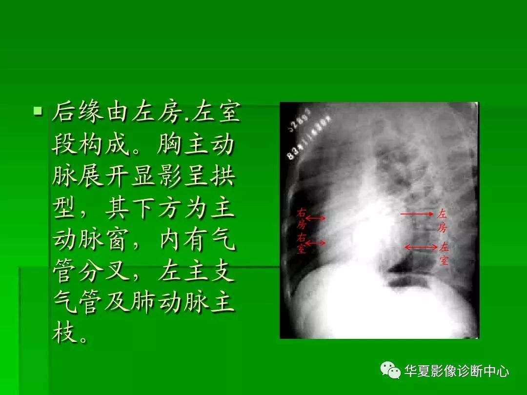 考试必备心脏x线各种位置详解