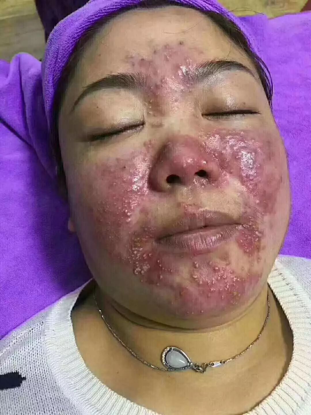 你的激素脸是怎么养成的