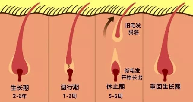 正常头发的生长周期包括生长期(anagen phase,退行期(catagen