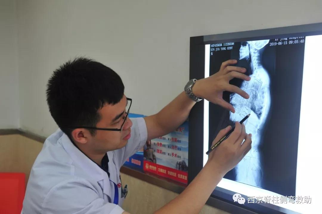 西京医院骨科脊柱畸形中心关爱侧弯61挺起脊梁脊柱侧弯大型义诊公益