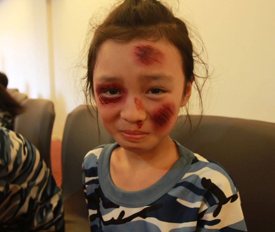 孩子们知道电影中的烧伤妆,疤痕妆是怎么出来的吗?