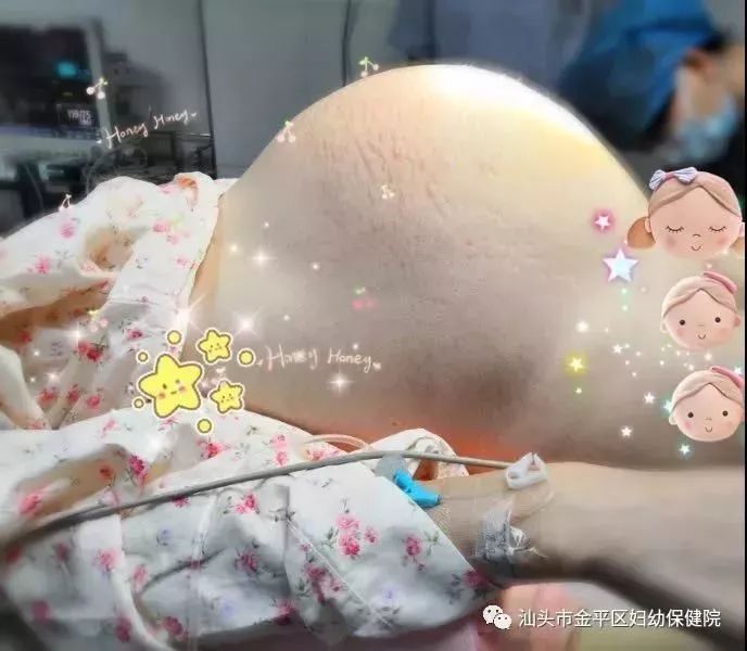 孕妇三胎大肚子图片