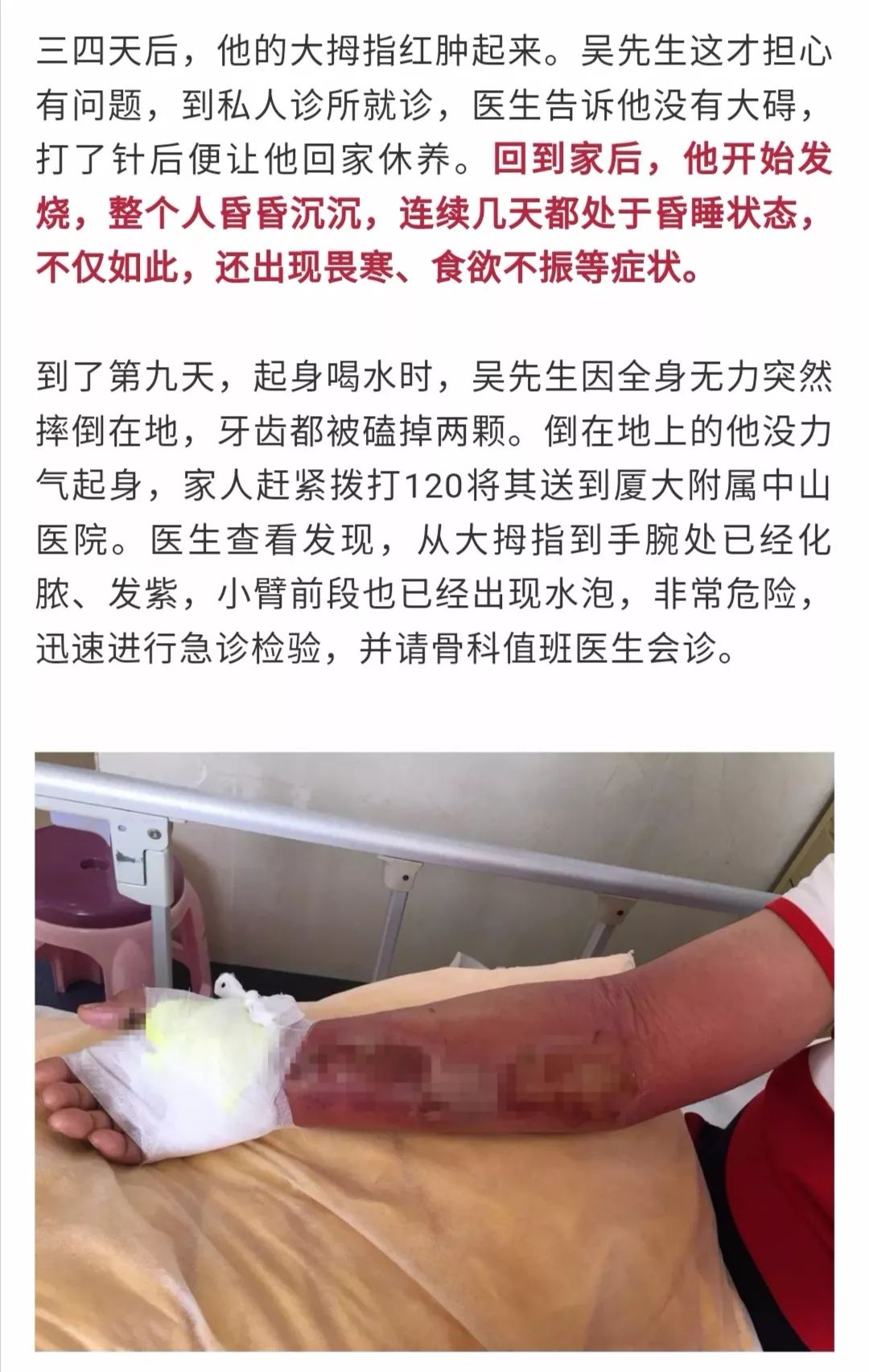 可怕本地男子洗虾被刺到9天后肝脏衰竭割开手臂筋都烂了