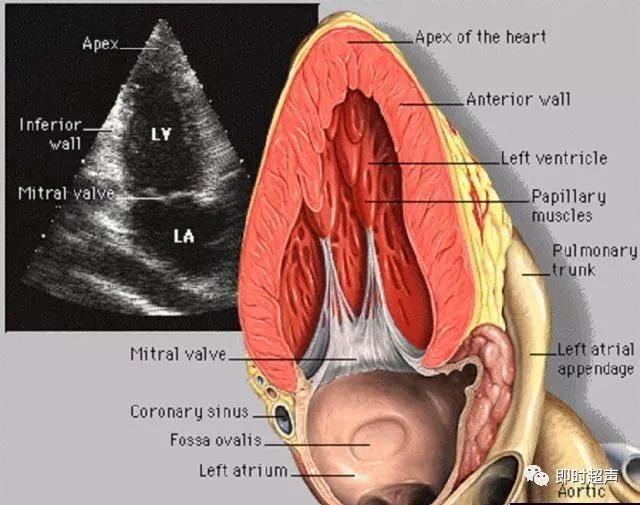 心臟超聲圖片與斷層解剖對照圖