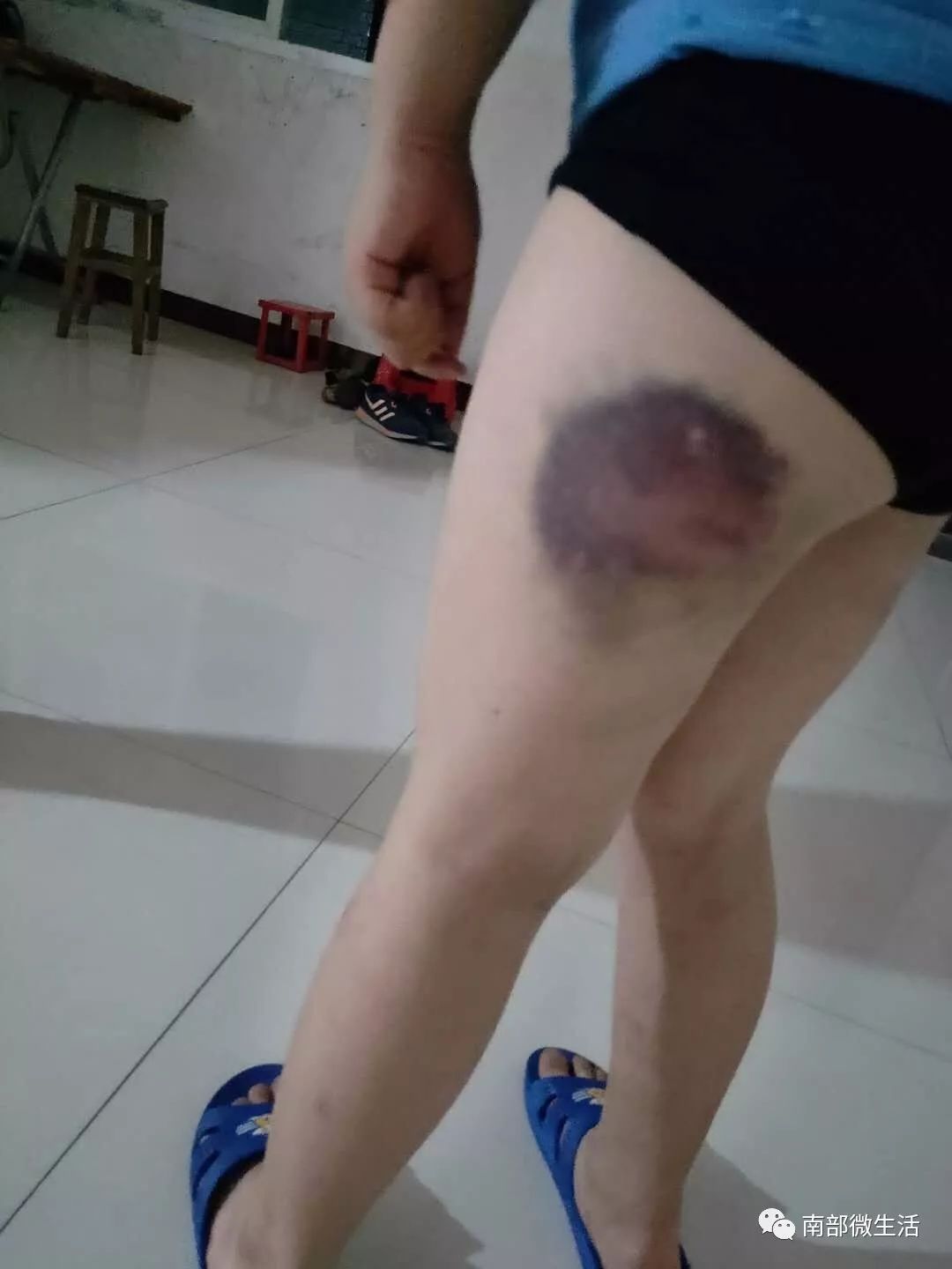 网曝南部某老师打8岁学生谁在说谎