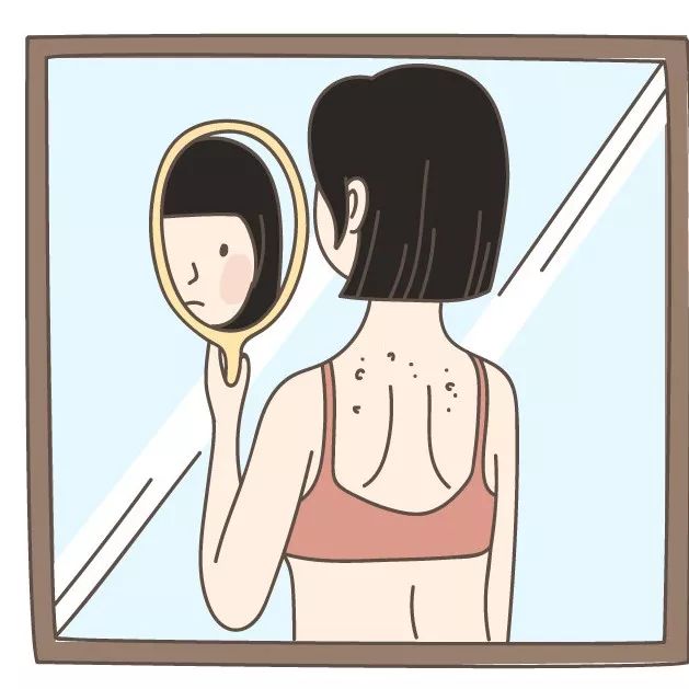 自从我基本战胜了后背上的各种痘痘君,就特别喜欢穿这类的衣服.