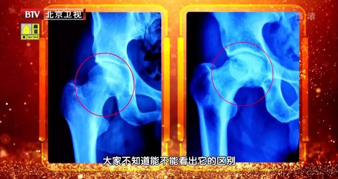 45岁后多数人的骨头变松变硬骨不正难长寿养骨柔筋还需这几招