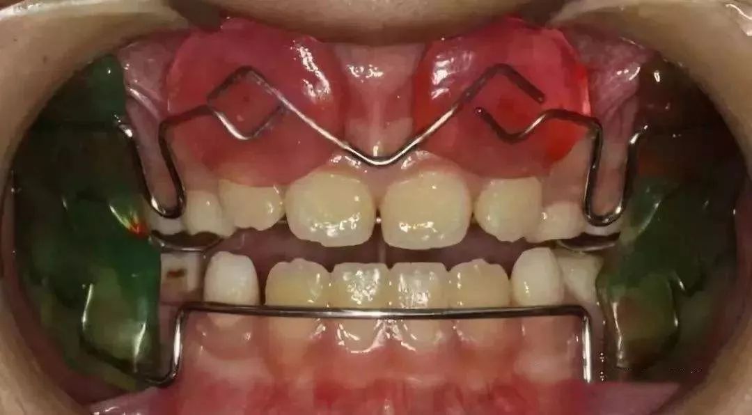 地包天的三生三世