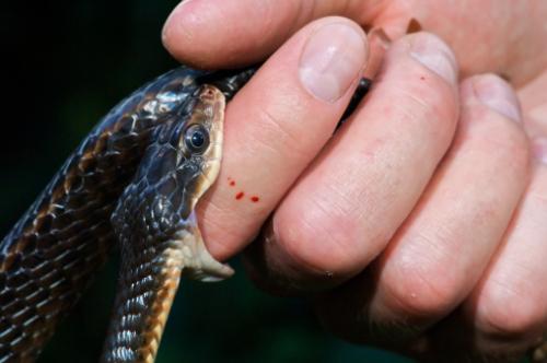 在农村蛇场买眼镜蛇煲汤1小时后被砍掉的蛇头咬伤会中毒吗