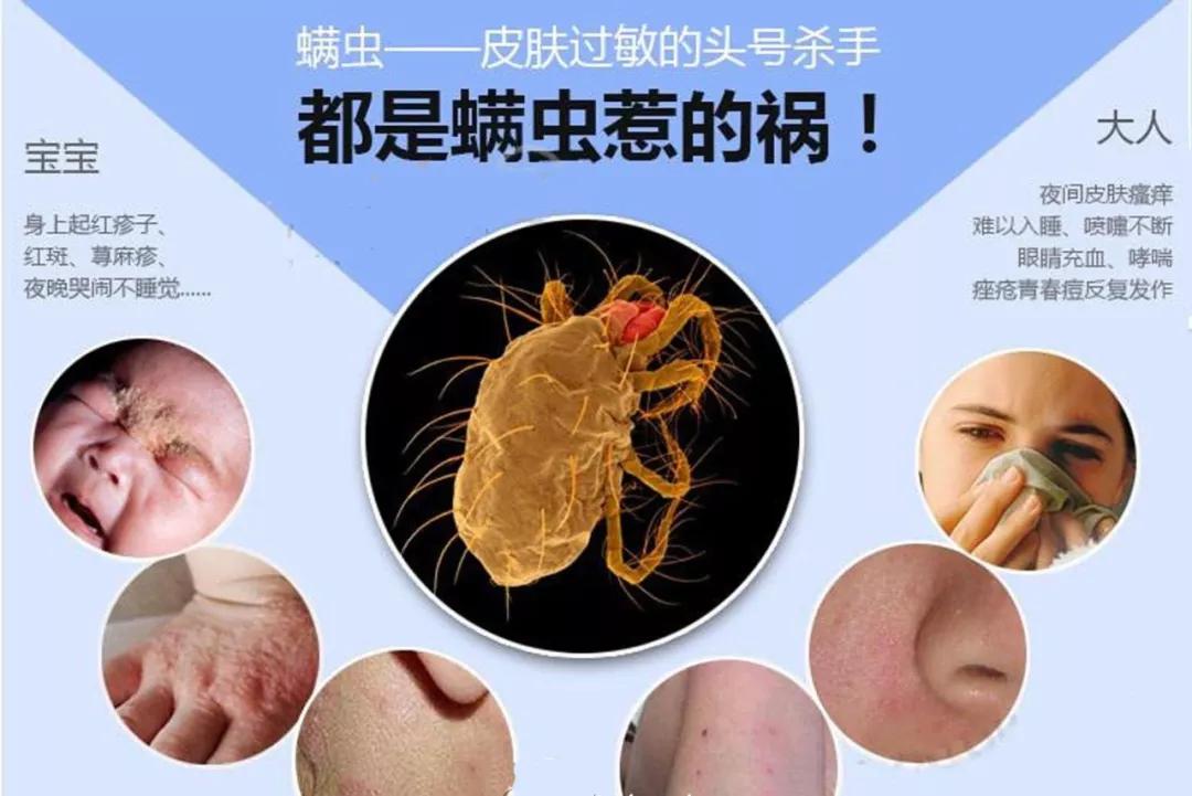 呼吸道也更为娇嫩,无法承受过敏性物质的刺激,在接触到螨虫过敏原时