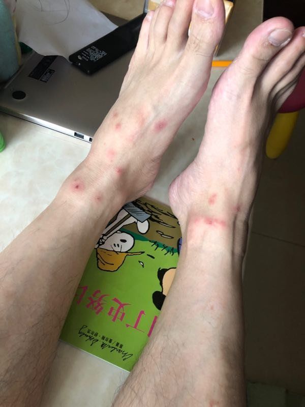 南宁两小区地下停车场遭跳蚤突袭业主进门抖抖腿跳蚤掉一地