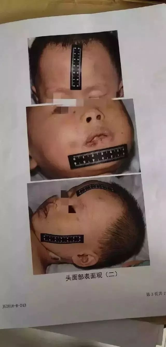 广西女童邓子琳死因成谜律师向警方提交新证据