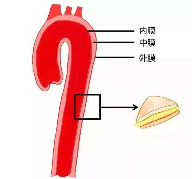 主动脉从心脏发出,承担体内大部分组织器官血供,是生命主干道