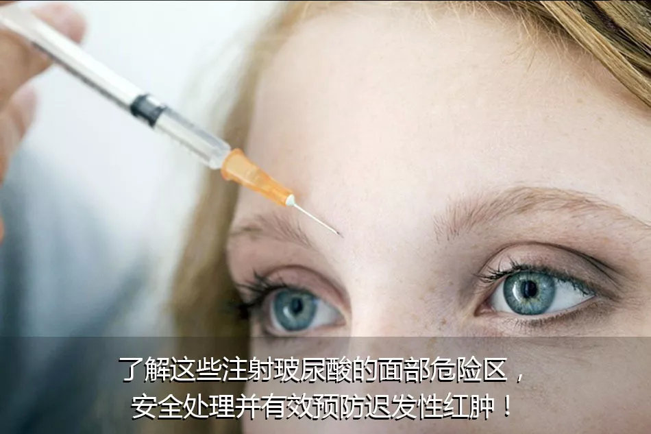 水肿体质的妹纸到底能不能注射玻尿酸