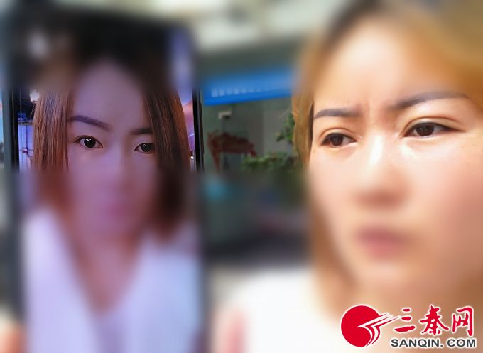 赵丽莉 图/记者 马昭)爱美的曹女士本想通过文眉,割双眼皮,开眼角等