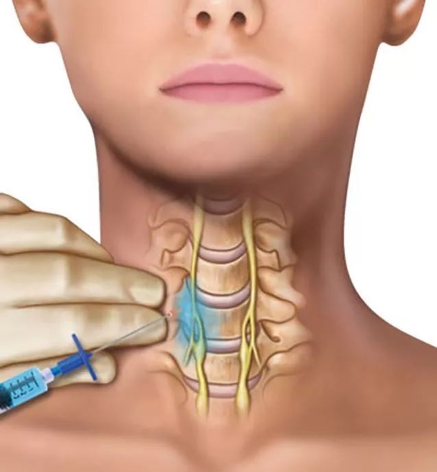 星状神经节与120种疾病