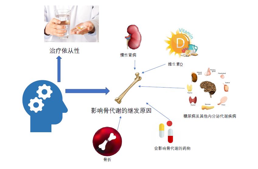 骨质疏松症治疗起效早知道亚太专家共识