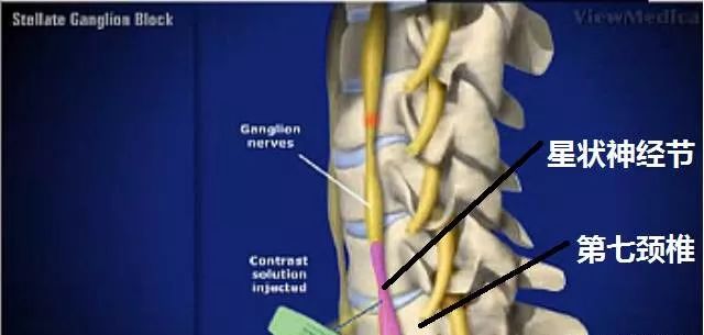 星状神经节与120种疾病