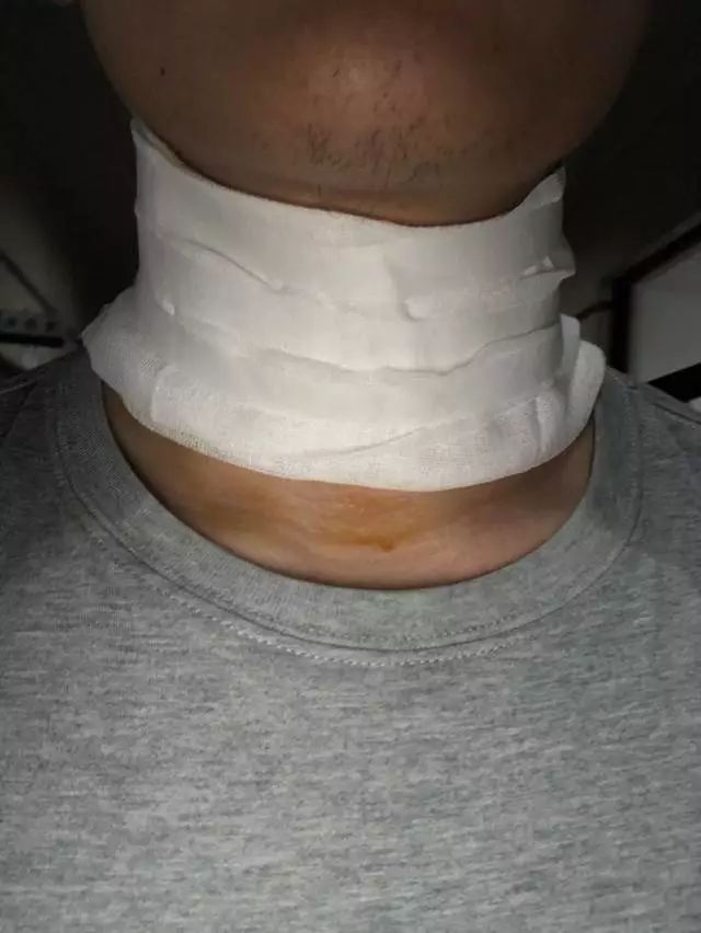 肇庆一男子途经堤围竟毫无征兆被割颈